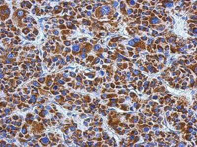 Immunohistochemistry-Paraffin: Dihydrolipoamide Dehydrogenase/DLD Antibody [NBP2-19361]