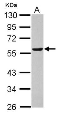 Western Blot: Dihydrolipoamide Dehydrogenase/DLD Antibody [NBP2-19361]