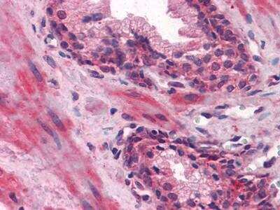 Immunohistochemistry-Paraffin: Lipocalin-1 Antibody (10B10) - BSA Free [NBP1-28872]