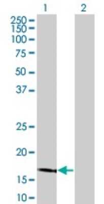 Western Blot: Lipocalin-1 Antibody (1B11) [H00003933-M02]