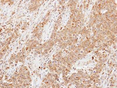 Immunohistochemistry-Paraffin: Lipocalin-1 Antibody [NBP2-19362]