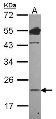 Western Blot: Lipocalin-1 Antibody [NBP2-19362]