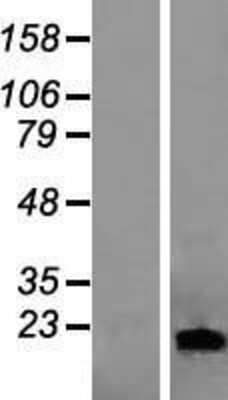 Western Blot: Lipocalin-1 Overexpression Lysate [NBL1-12462]