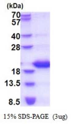 SDS-PAGE: Recombinant Human Lipocalin-1 His Protein [NBP2-51828]