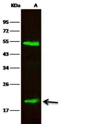 Western Blot: Lipocalin-2/NGAL Antibody (128) [NBP2-89346]