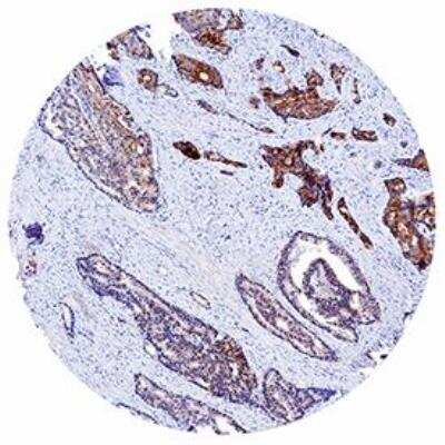 Immunohistochemistry-Paraffin: Lipocalin-2/NGAL Antibody (972737) [MAB17572]