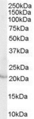 Western Blot: Lipocalin-2/NGAL Antibody [NB100-1503]