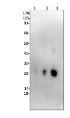 Western Blot: Lipocalin-2/NGAL Antibody [NBP1-45682]