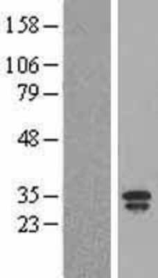 Western Blot: Lipocalin-2/NGAL Overexpression Lysate [NBL1-12463]