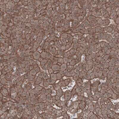 Immunohistochemistry-Paraffin: Lipolysis Stimulated Lipoprotein Receptor Antibody [NBP1-89631]