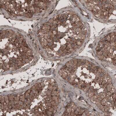Immunohistochemistry-Paraffin: Lipolysis Stimulated Lipoprotein Receptor Antibody [NBP1-89631]