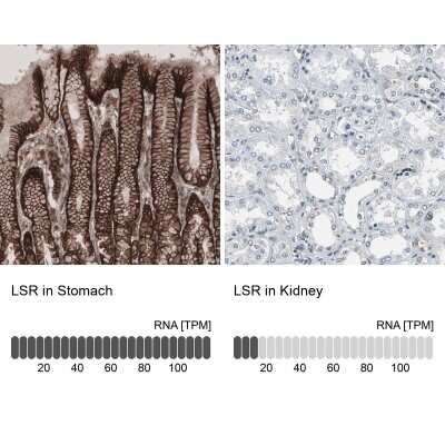 Immunohistochemistry-Paraffin: Lipolysis Stimulated Lipoprotein Receptor Antibody [NBP1-89631]