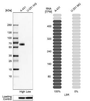 Western Blot: Lipolysis Stimulated Lipoprotein Receptor Antibody [NBP1-89631]