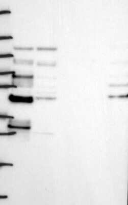 Western Blot: Lipolysis Stimulated Lipoprotein Receptor Antibody [NBP3-17879]