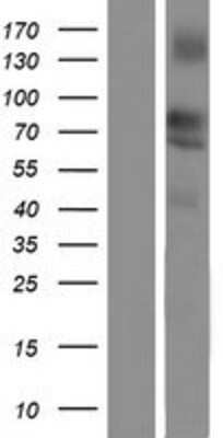 Western Blot: Lipolysis Stimulated Lipoprotein Receptor Overexpression Lysate [NBP2-07113]