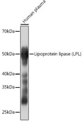 Western Blot: Lipoprotein Lipase/LPL Antibody (10E10P9) [NBP3-16334]