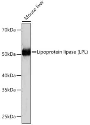 Western Blot: Lipoprotein Lipase/LPL Antibody (10E10P9) [NBP3-16334]