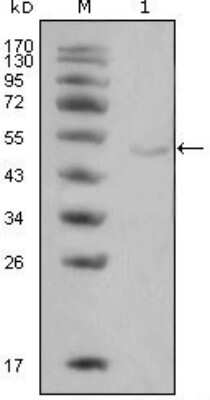 Western Blot: Lipoprotein Lipase/LPL Antibody (2C5)BSA Free [NBP1-51565]