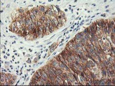 Immunohistochemistry-Paraffin: Lipoprotein Lipase/LPL Antibody (OTI3A10) [NBP2-01395]