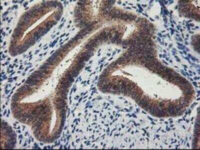 Immunohistochemistry-Paraffin: Lipoprotein Lipase/LPL Antibody (OTI3A10) [NBP2-01395]