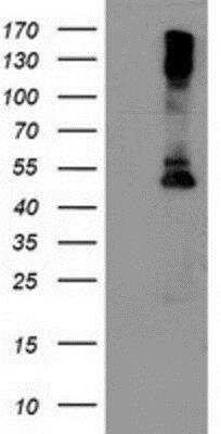 Western Blot: Lipoprotein Lipase/LPL Antibody (OTI3A10) [NBP2-01395]