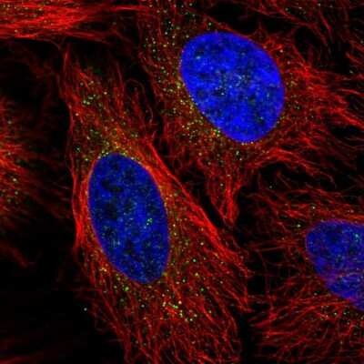 Immunocytochemistry/ Immunofluorescence: Lipoprotein Lipase/LPL Antibody [NBP2-58366]