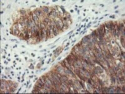 Immunohistochemistry: Lipoprotein Lipase/LPL Antibody (OTI3A10) - Azide and BSA Free [NBP2-71178]