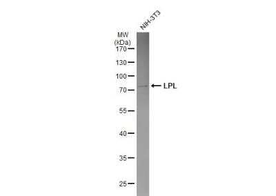 Western Blot: Lipoprotein Lipase/LPL Antibody [NBP1-32215]