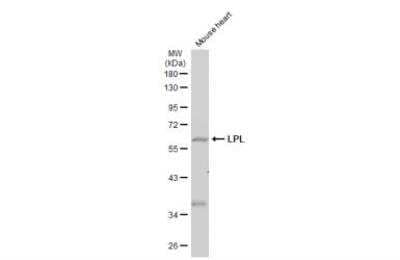 Western Blot: Lipoprotein Lipase/LPL Antibody [NBP2-19364]