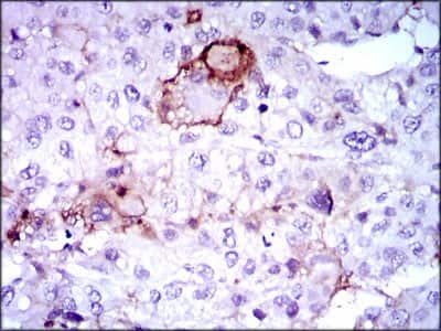 Immunohistochemistry-Paraffin: Lipoprotein a Antibody (4H1) - BSA Free [NBP2-37477]