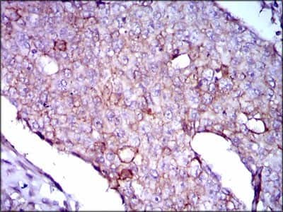 Immunohistochemistry-Paraffin: Lipoprotein a Antibody (4H1) - BSA Free [NBP2-37477]