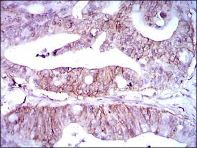 Immunohistochemistry-Paraffin: Lipoprotein a Antibody (4H1) - BSA Free [NBP2-37477]