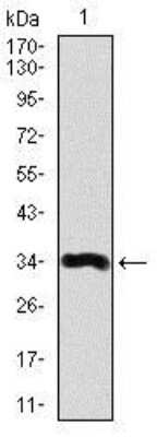 Western Blot: Lipoprotein a Antibody (4H1)BSA Free [NBP2-37477]