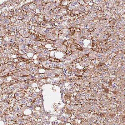 Immunohistochemistry-Paraffin: Lipoprotein a Antibody [NBP2-49318]