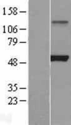 Western Blot: Lipoprotein Lipase/LPL Overexpression Lysate [NBL1-12656]