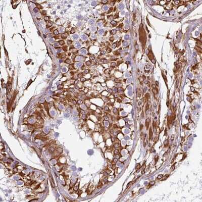 Immunohistochemistry-Paraffin: Liprin alpha 1 Antibody [NBP2-38494]