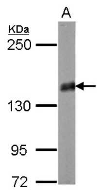 Western Blot: Liprin alpha 2 Antibody [NBP2-15018]