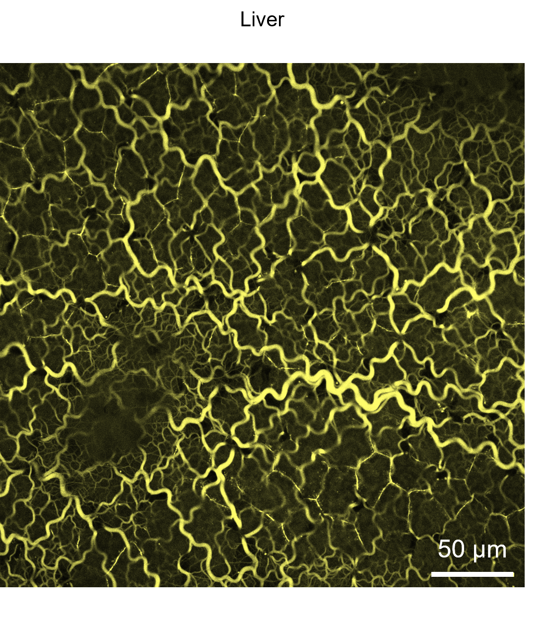 Use of Rhobo6 ECM Dye for labeling the extracellular matrix (ECM) in liver kidney tissues.