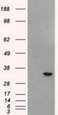 Western Blot: Livin Antibody (OTI1D12) [NBP2-02177]