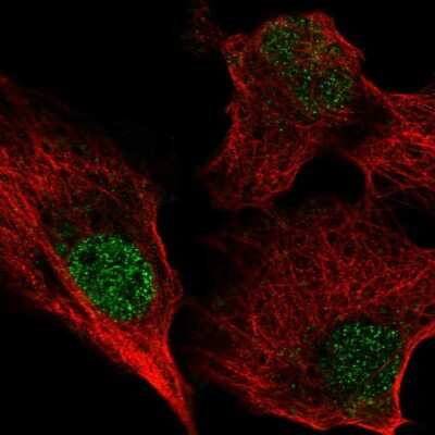 Immunocytochemistry/ Immunofluorescence: Livin Antibody [NBP2-56859]