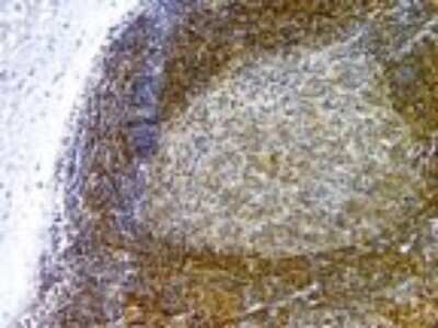 Immunohistochemistry: Livin Antibody [NB100-56145]