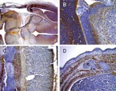 Immunohistochemistry-Paraffin: Livin Antibody [NB100-56145]
