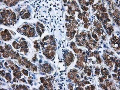Immunohistochemistry: Livin Antibody (OTI1D12) - Azide and BSA Free [NBP2-72206]