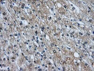 Immunohistochemistry: Livin Antibody (OTI1D12) - Azide and BSA Free [NBP2-72206]