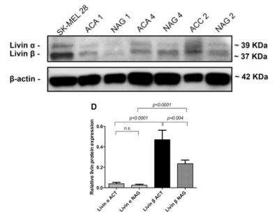 Western Blot: Livin Antibody [NB100-56145]