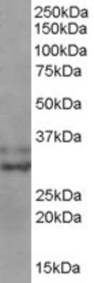 Western Blot: Livin Antibody [NB300-941]