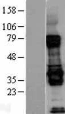 Western Blot: Livin Overexpression Lysate [NBL1-07988]