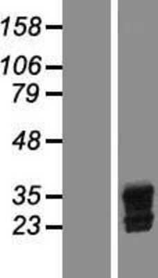 Western Blot: Livin Overexpression Lysate [NBP2-06455]