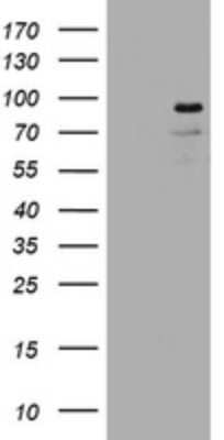 Western Blot: Lnx1 Antibody (OTI1H9) [NBP2-45794]