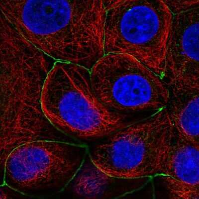 Immunocytochemistry/ Immunofluorescence: Lnx1 Antibody [NBP2-58844]